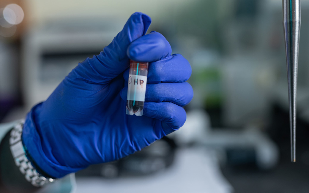 A vial of sorghum components held by a gloved hand.